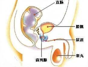 慢性前列腺炎会不会遗传