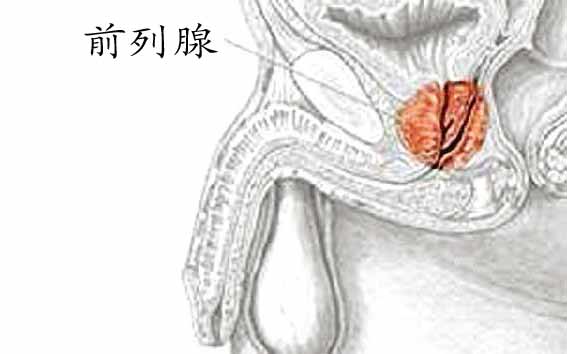 前列腺囊肿患者护理中心费用